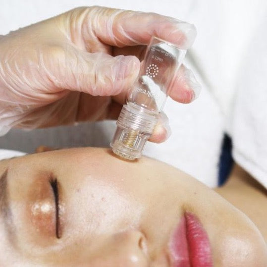 FACIAL HYDRANEEDLE | DEPOSITÓ $20