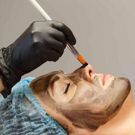 CARBON PEEL |DEPOSITÓ $20
